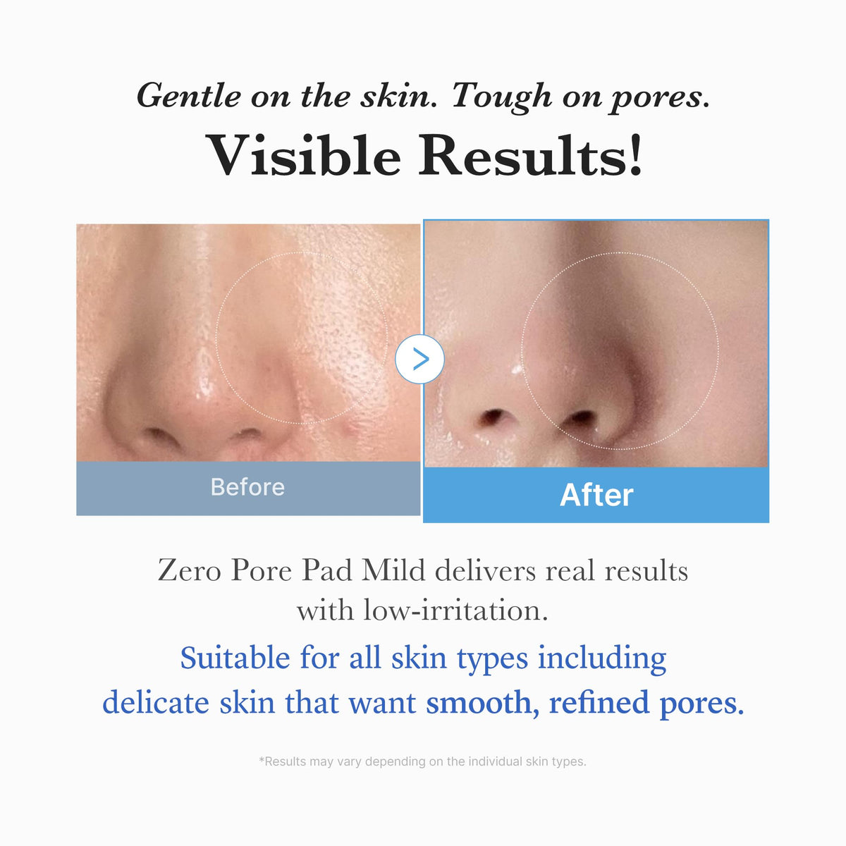medicube Toner Pads Zero Pore Pad Mild 2.0 (70 Pads)