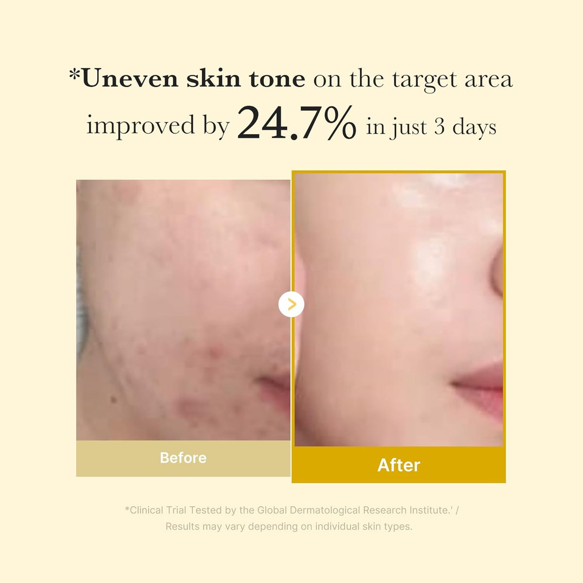 Medicube Kojic Acid Turmeric Night Wrapping Mask -75ml/2.53OZ