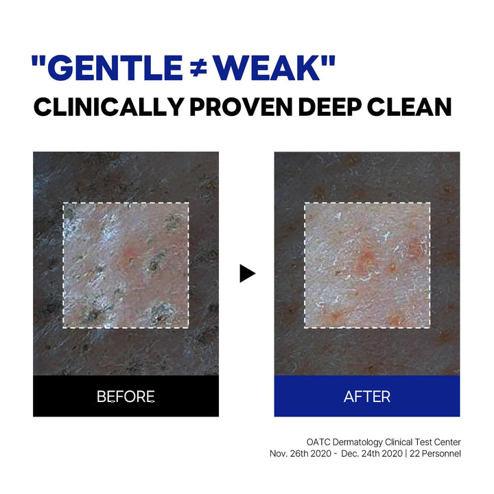 ROUND LAB Birch Juice Moisturizing Cleanser 150 ml