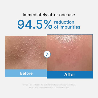 Medicube Zero Pore Blackhead Cleansing Oil | Makeup Remover for all skin types 80g