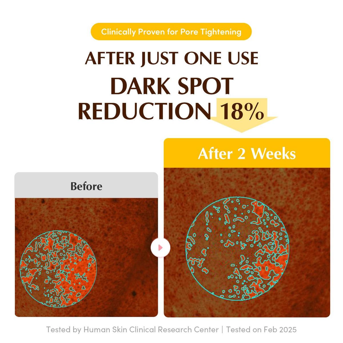 EQQUALBERRY Collagen Glow Up Hydrogel Mask (4 Sheets)