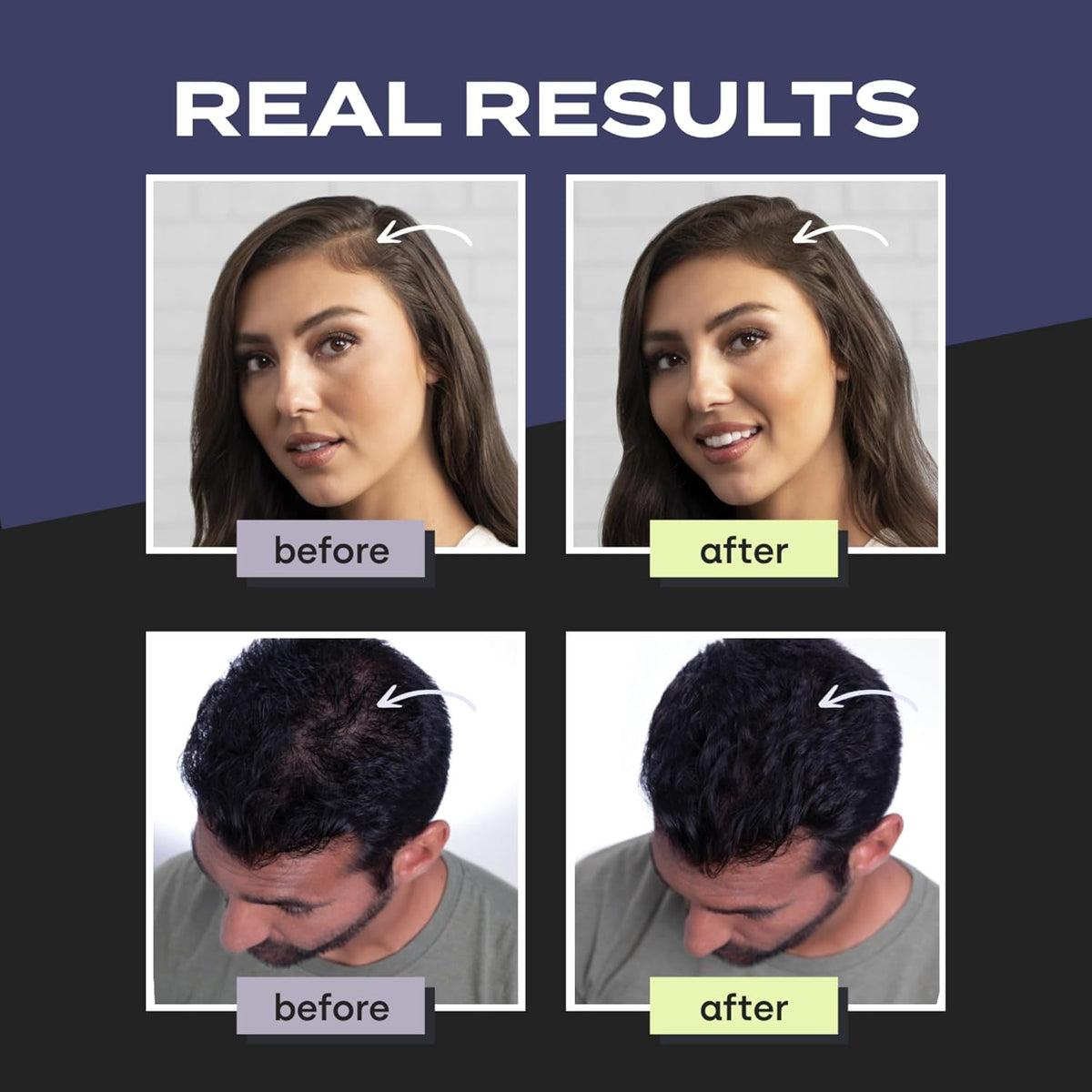 Toppik Hair Building Fibers Black 12 G