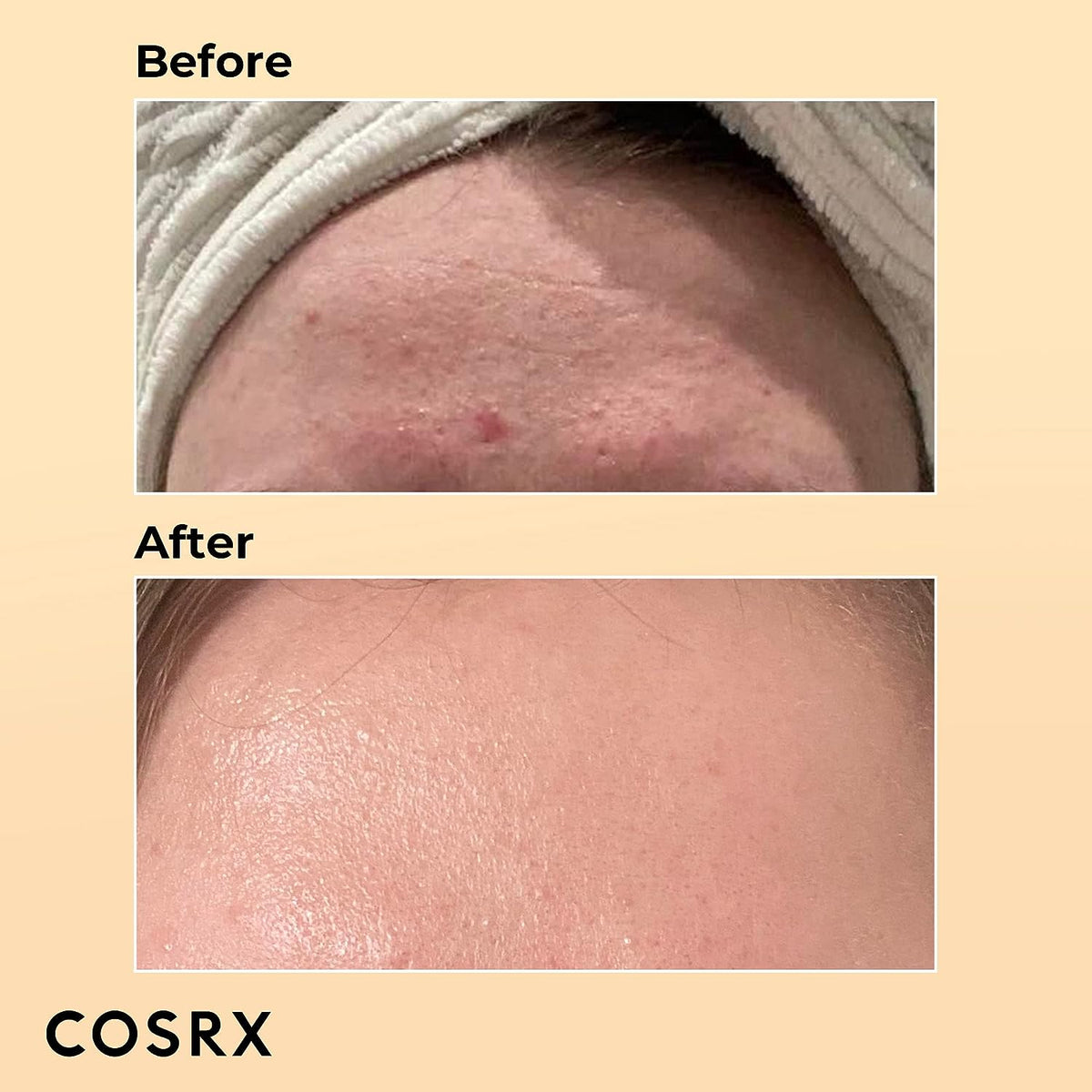Pack of Two : COSRX Advance Snail 96 Mucin Power Essence 100ml