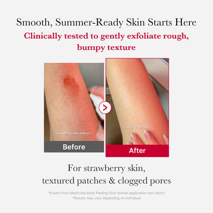 Medicube Red Acne Body Peeling Shot, AHA + BHA Exfoliating Body Spray 110g