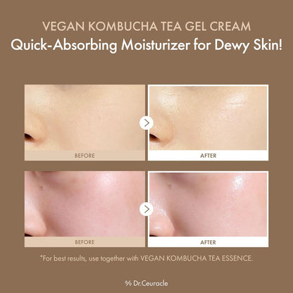 Dr.Ceuracle VEGAN KOMBUCHA TEA GEL CREAM 75g