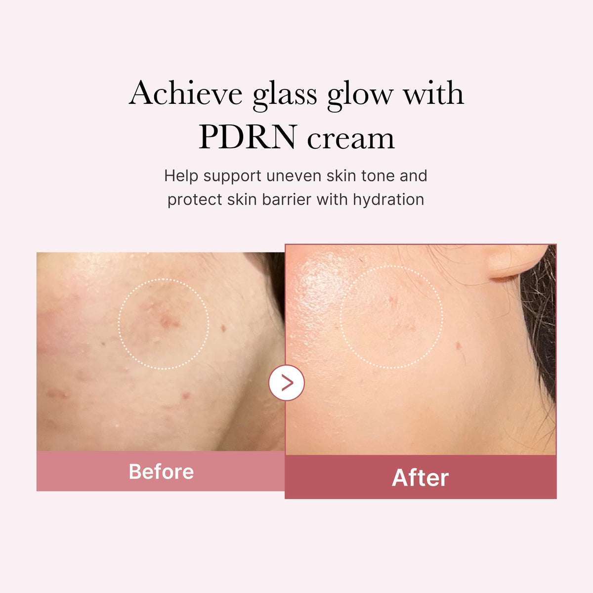 Medicube Salmon DNA PDRN Pink Hyaluronic Moisturizing Cream 50ml