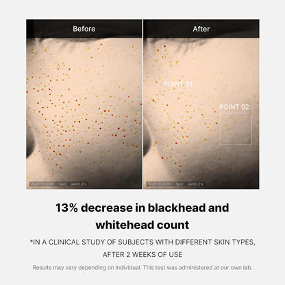 MEDICUBE Zero Pore One Day Serum (30ml)