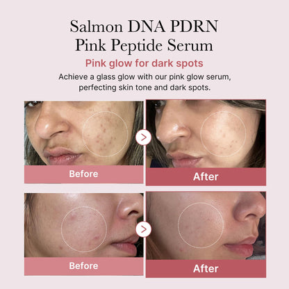 Medicube PDRN Pink Peptide Serum 1.01 fl oz (30 ml)