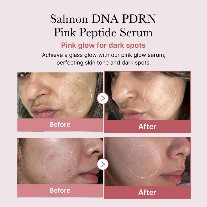 Medicube PDRN Pink Peptide Serum 1.01 fl oz (30 ml)