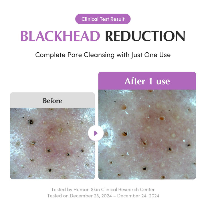 EQQUALBERRY Purple Rice Pore Purifying Pack Cleanser 130g