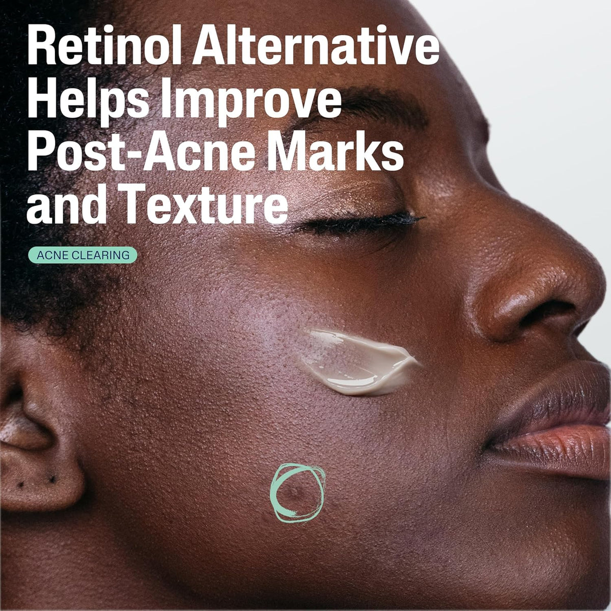 CETAPHIL Gentle Clear Repairing Post-Acne Serum, Retinol Alternative, Oil Free Serum 1 Fl Oz
