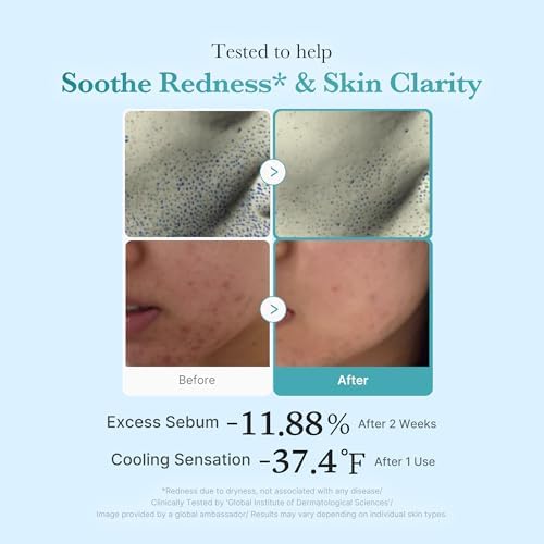 Medicube - Azelaic Acid Niacinamide Clear Toner - 250ml