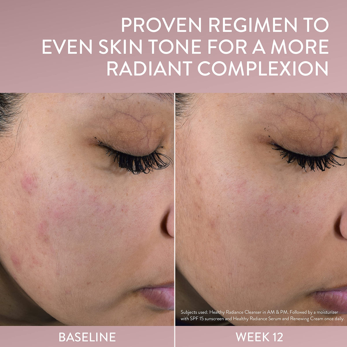Cetaphil Healthy Radiance PHA Exfoliating Face Wash Before and after comparison of skin tone improvement with text on a beige background