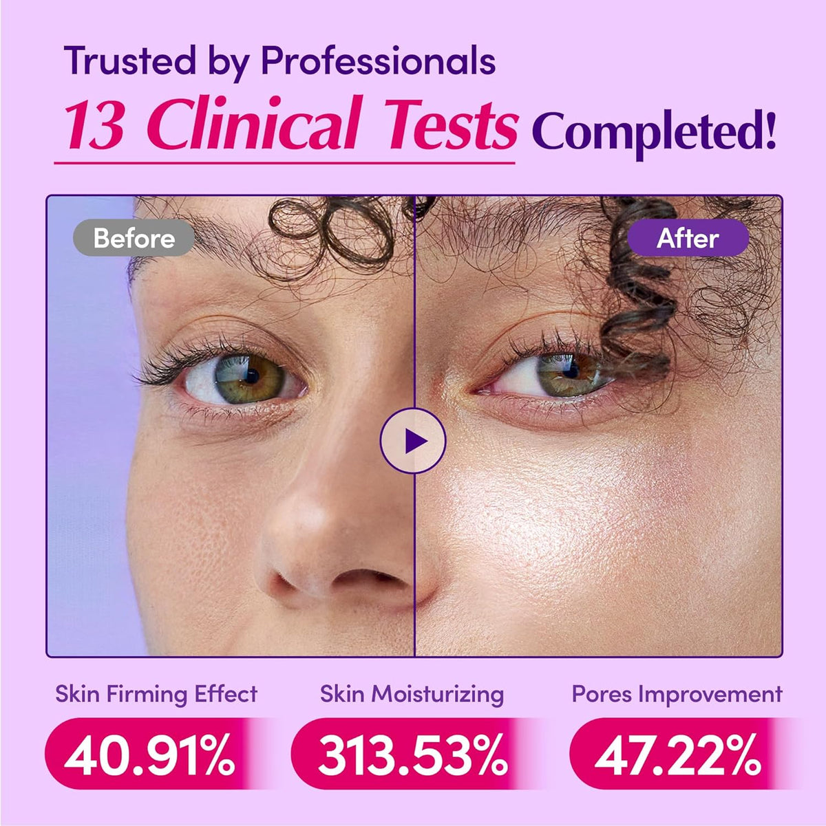 Before and after skin treatment comparison with EQQUALBERRY Deep Cera Bakuchiol Plumping Serum results on a purple background