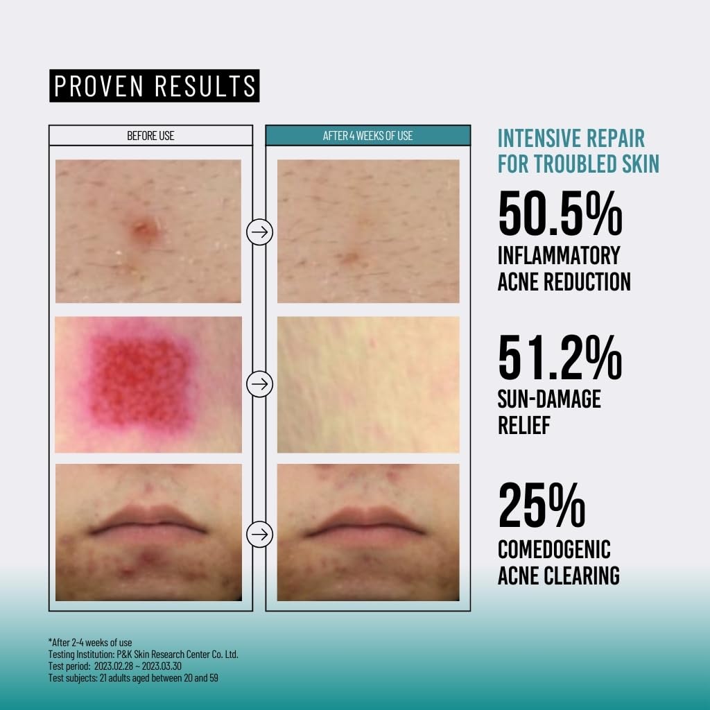 Before and after skin JUMISO Snail Mucin 95% Peptide Essence with statistical data on skin improvement.