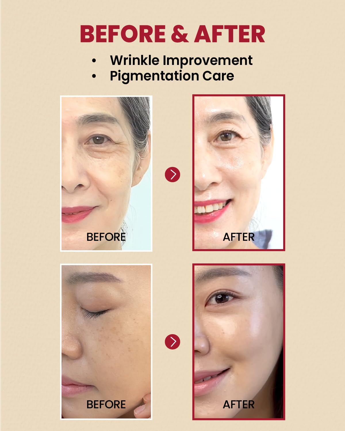 Before and after comparison of wrinkle improvement and pigmentation care on a person's face.