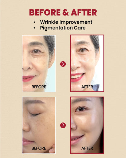 Before and after comparison of wrinkle improvement and pigmentation care on a person's face.