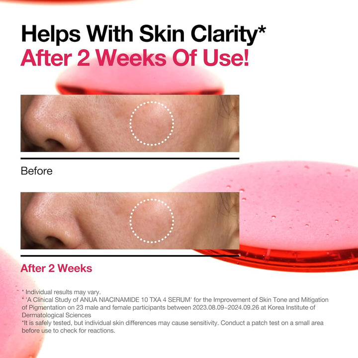 NIACINAMIDE 10% + TXA 4% SERUM 30ml